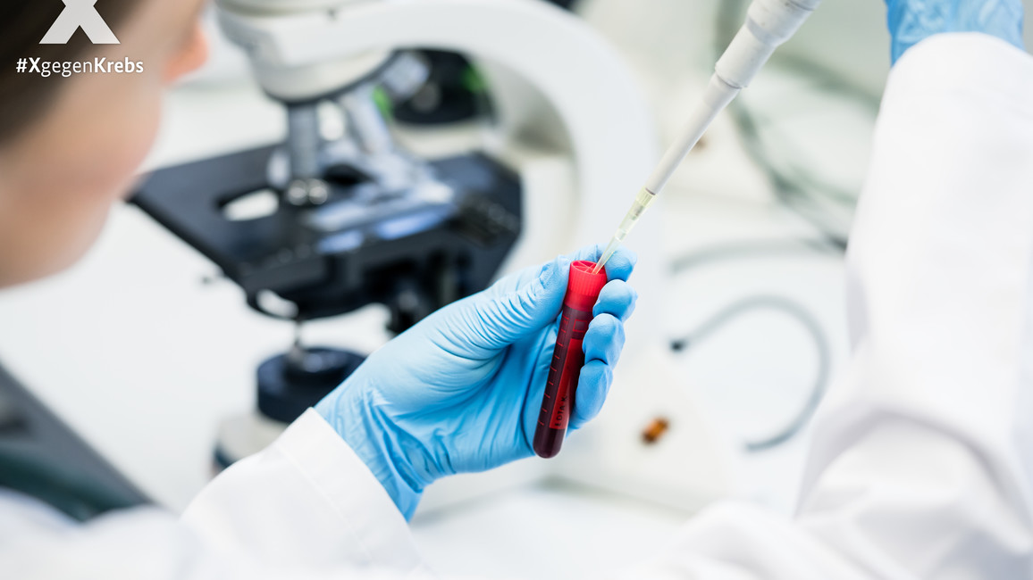Bluttest im Labor